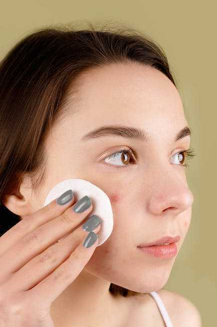 The Best Acne Treatments for Combination Skin