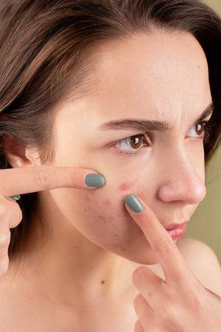 How to Choose the Right Treatment for Your Acne Scars