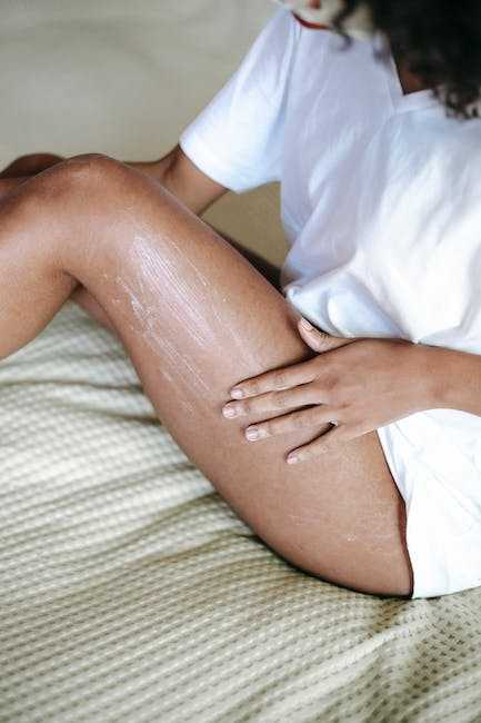 Natural Remedies for Treating Spider Veins at Home