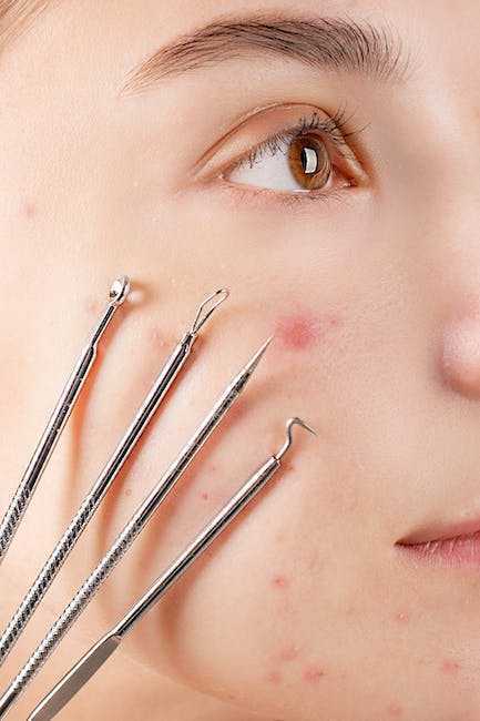 The Science Behind Acne Scars: What Happens to Your Skin