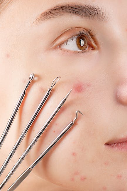 Propionibacterium acnes